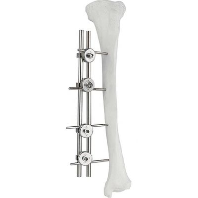 Ambulatorio esterno tibiale Fixator dell'osso di Fixator del femore ortopedico dell'impianto