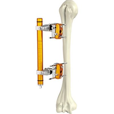 Asse omerale ortopedica medica Fixator esterno degli strumenti chirurgici