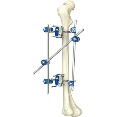 Tibia ortopedica dello strumento eccellente di qualità & strumenti chirurgici ortopedici di Fixator di esterno di Percone