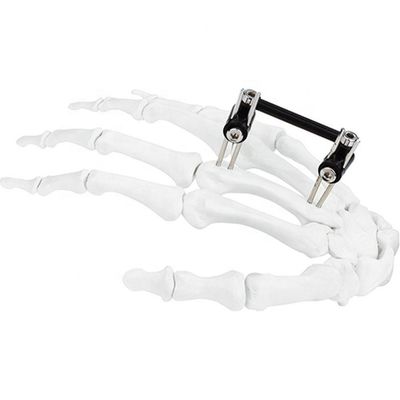 Dispositivo chirurgico ortopedico di Mini Fragment Ilizarov External Fixation