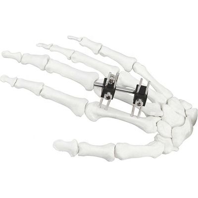 Dispositivo chirurgico ortopedico di Mini Fragment Ilizarov External Fixation