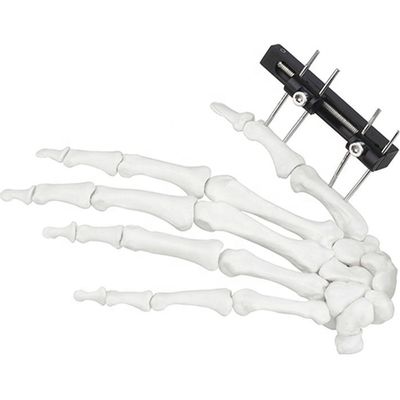 Dispositivo chirurgico ortopedico di Mini Fragment Ilizarov External Fixation