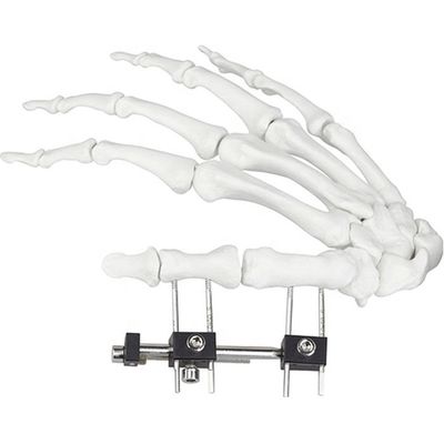 Dispositivo chirurgico ortopedico di Mini Fragment Ilizarov External Fixation