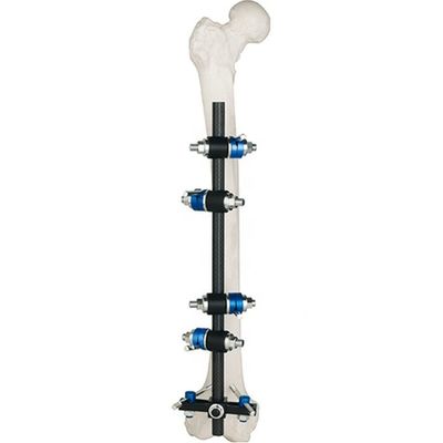 Femore Fixator esterno tibiale