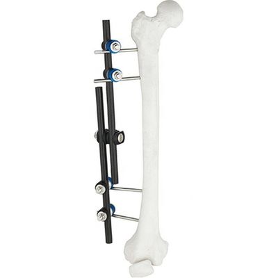 Strumenti chirurgici ortopedici di vendita calda tibiali &amp; strumento ortopedico di fissazione esterna di Fixator AO di esterno del femore