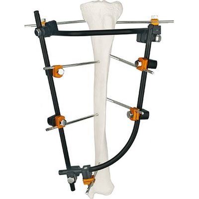 Insieme di titanio medico di qualità degli strumenti chirurgici di Fixator dello strumento degli strumenti esterni ortopedici eccellenti dell'insieme-III