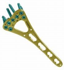 Fissazione distale del piatto di frattura della clavicola di Accumed della clavicola del gancio della spalla